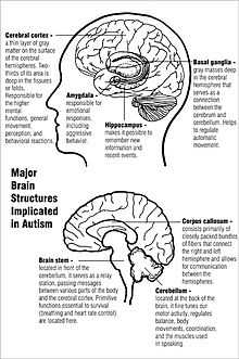 Deux schémas de grandes structures cérébrales impliquées dans l'autisme. Le diagramme du haut montre le cortex cérébral près du sommet et les noyaux gris centraux dans le centre, juste au-dessus de l'amygdale et l'hippocampe. Le diagramme ci-dessous montre le corps calleux près du centre, le cervelet à l'arrière inférieur et le tronc cérébral en bas au centre.