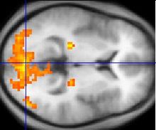 Imagem monocromática fMRI de um corte horizontal de um cérebro humano. Algumas regiões, principalmente na parte de trás, são destacados em laranja e amarelo.