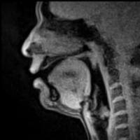 Arquivo: em tempo real MRI - Falando (chinês) .ogv