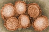 Vírus H1N1